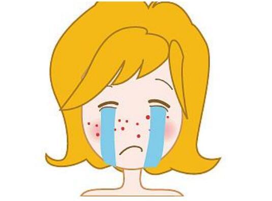 留痘印的真正原因被找到,并不是挤痘,原来是这3个习惯