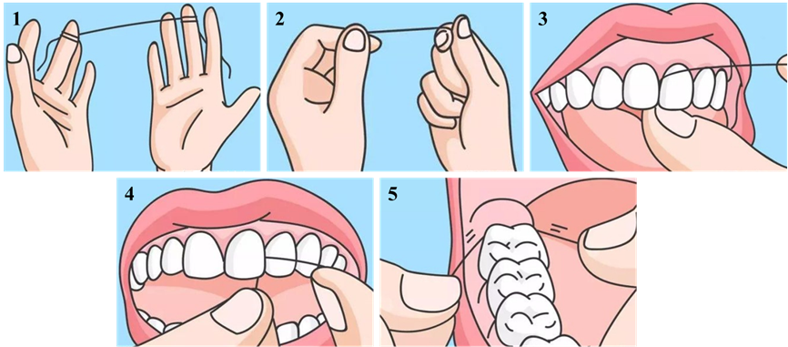 牙线科普丨不用牙线你的牙齿有一半永远是脏的
