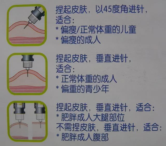 用胰岛素泵会增加治疗费用吗?不会,对比就知道打针其实不划算!