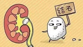 外科系三病区主任韩前河表示:泌尿系结石又称尿石症或尿路结石,包括