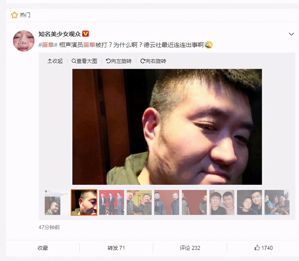相声演员苗阜被揍牵扯德云社,你们不看相声,也不看新闻?_腾讯新闻