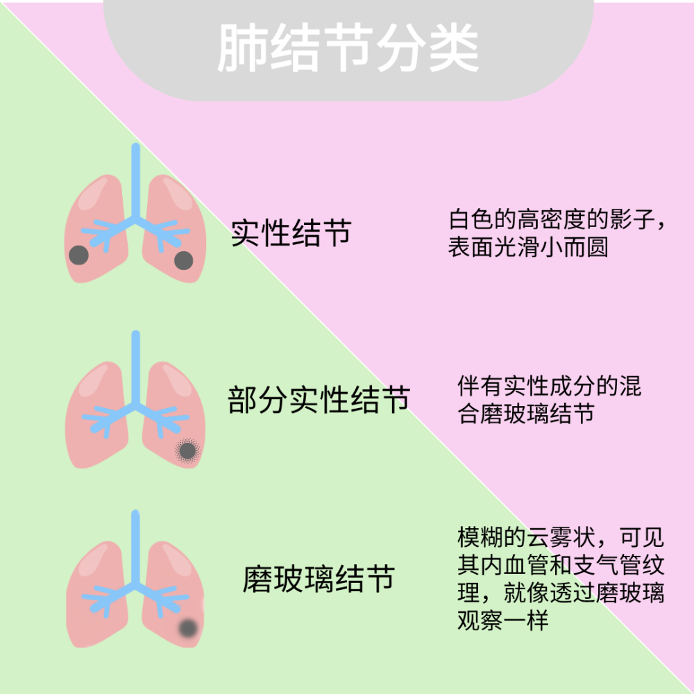 超1亿中国人受"肺结节"困扰,还能买保险吗?_腾讯新闻