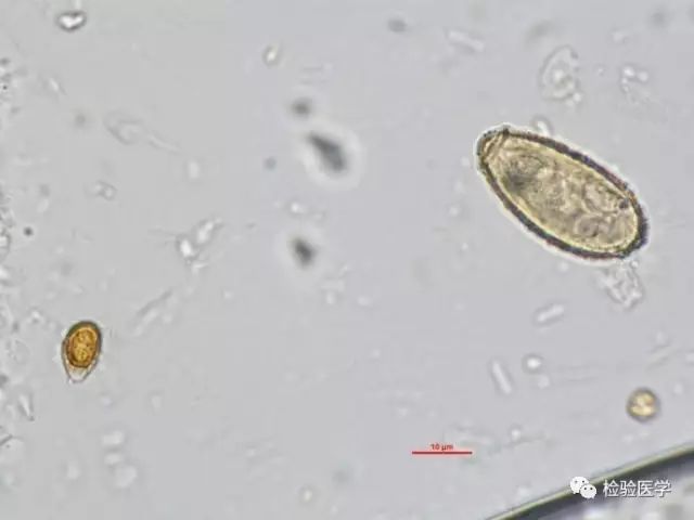 另外因为灵芝孢子和肝吸虫虫卵在显微镜下略有相似,如果服用之后去