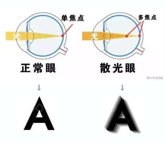 【科普】如何辨别自身是哪种散光?