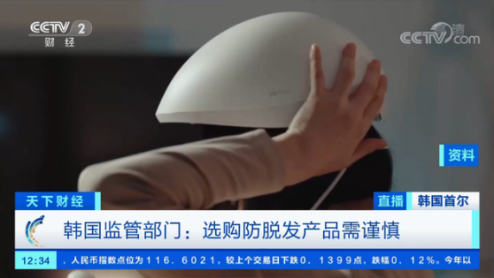 韩脱发人口1000万_脂溢性脱发图片