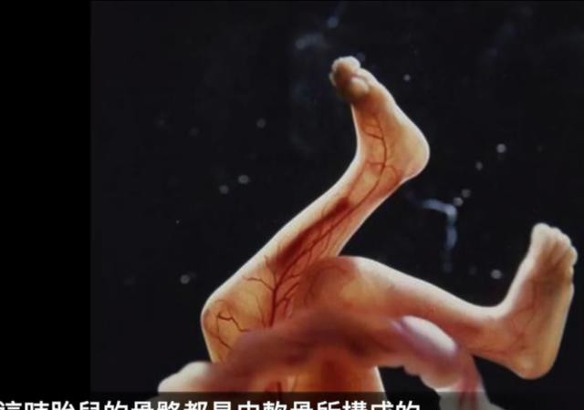 胎儿几个月四肢长全这个阶段胎儿容易畸形,孕妈要注意3个事项