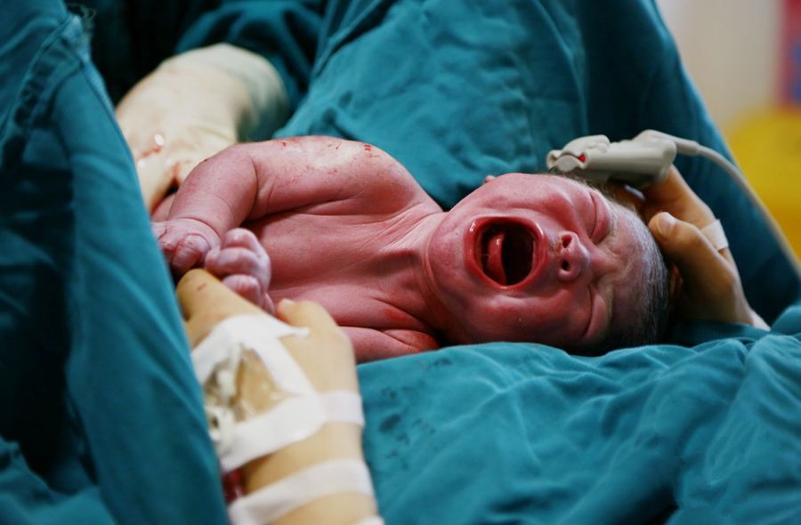 刚出生的宝宝很"坚强",护士反手一巴掌,用行动给他们上了一课