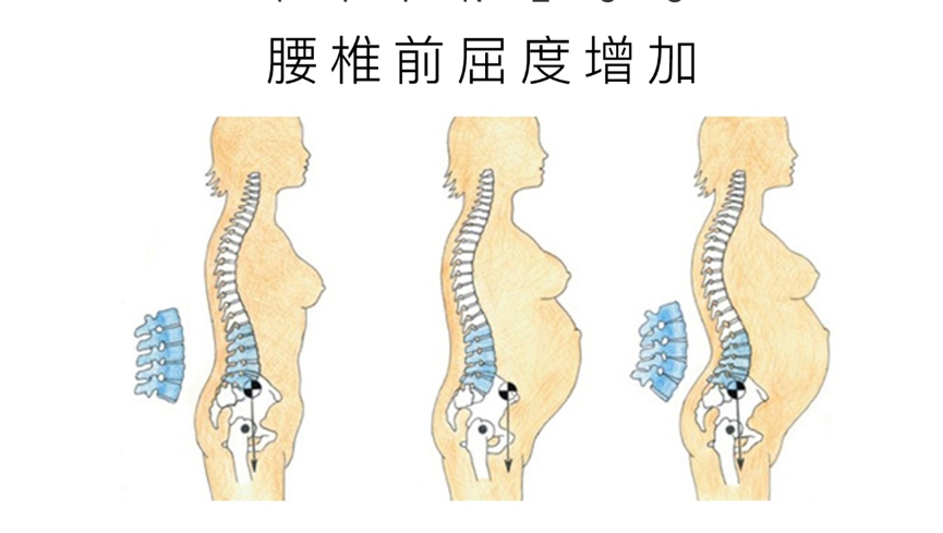 怀孕期间身体姿态发生变化,肌肉受力跟随改变,而在产后,大部分妈妈却