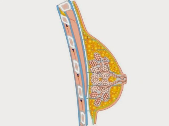 乳腺增生性病变,包括普通导管增生,乳管内乳头状瘤,硬化性腺病,放射状