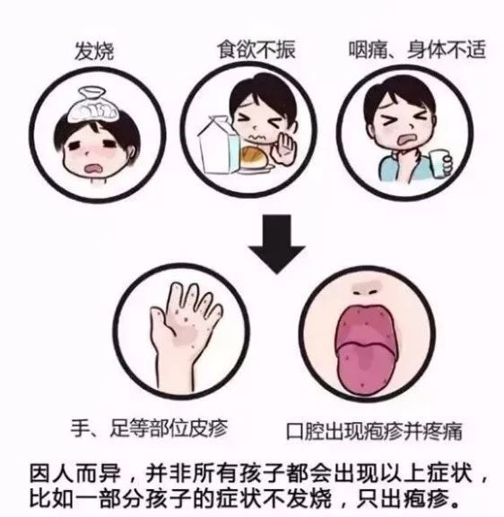 发病后第一周传染性最强. ◆什么时候是手足口病的高发季节?