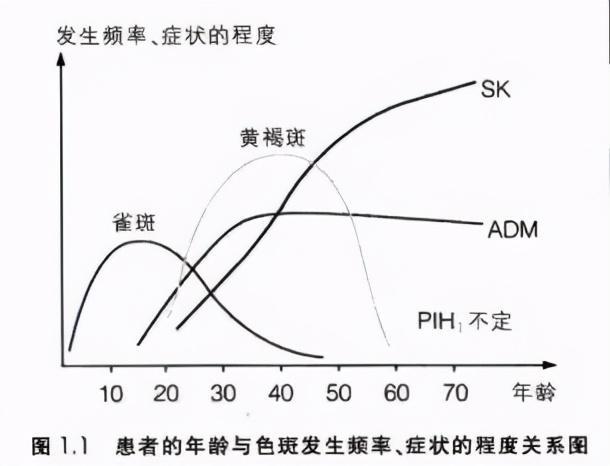 adm(褐青色痣)