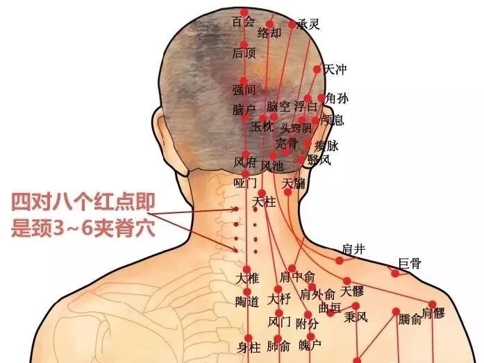 中医针灸精髓:醒脑三针,调理中风,值得收藏