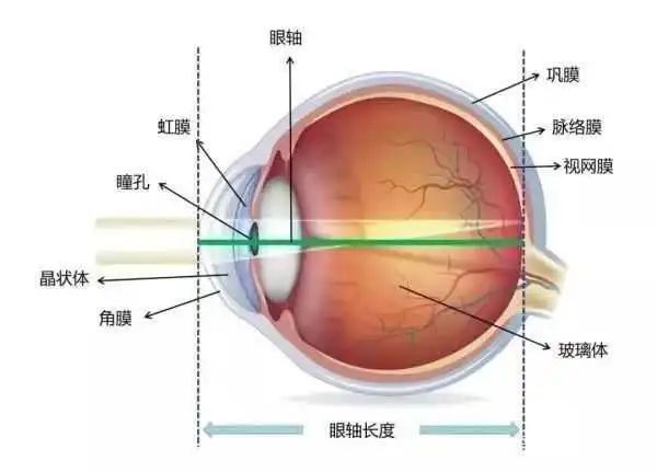 眼睛结构你了解吗?究竟什么是屈光不正