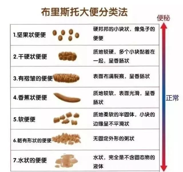 大便变细就是得了肠癌?医生说:大多数是良性疾病