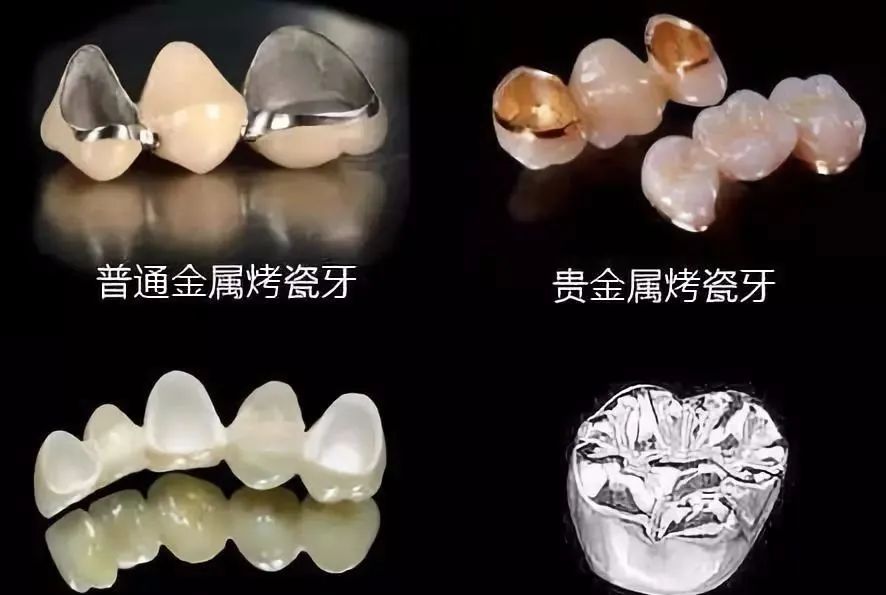 口腔義齒3d打印_研發3d打印 小義齒上大文章_3d打印義齒視頻