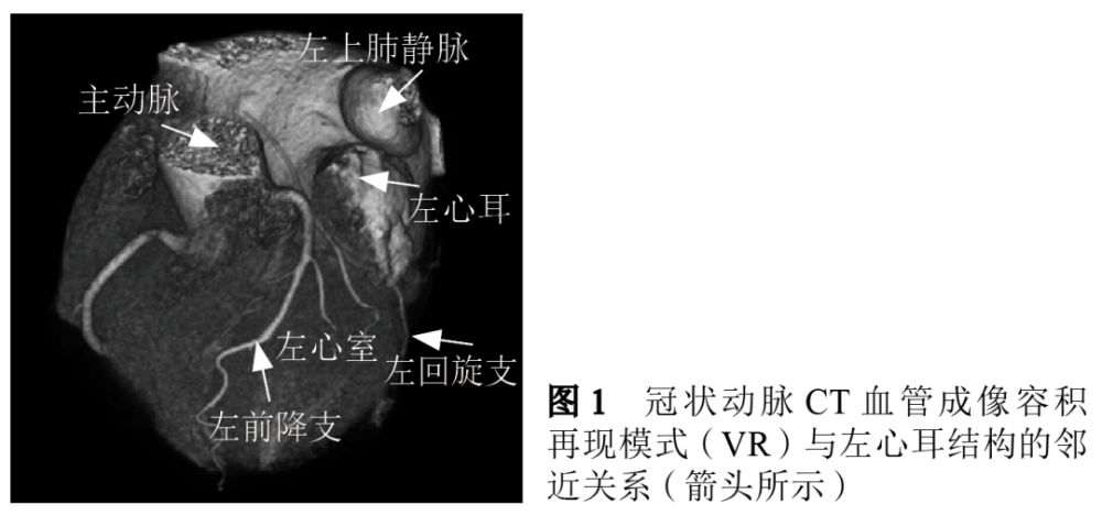 冠状动脉ct血管成像对左心耳封堵术的临床应用价值