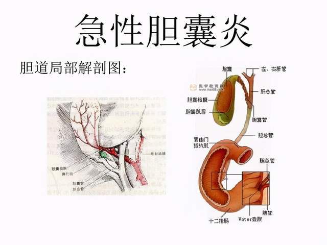 出现这4种症状,当心胆囊炎已经找上你了!