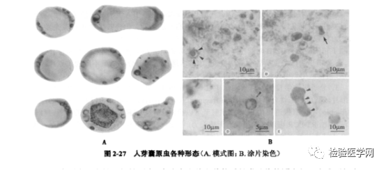 一诗忆起人芽囊原虫原来它可以这么美