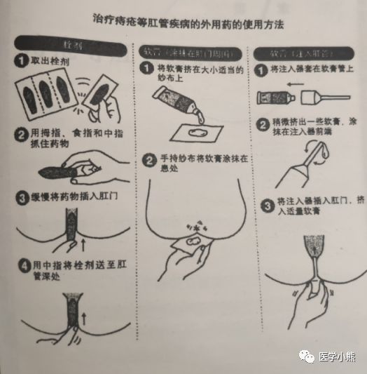 得了痔疮用什么药效果好?