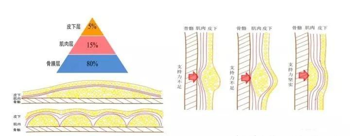 填充层次是由深到浅多层次注射,从骨骼,骨膜,深层脂肪,到表情肌筋膜层