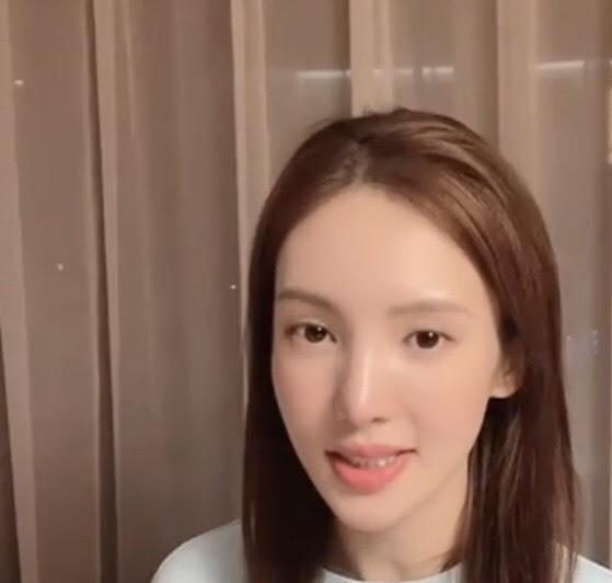 金晨近照颜值再翻车,继嘴歪之后,又一整容后遗症显现
