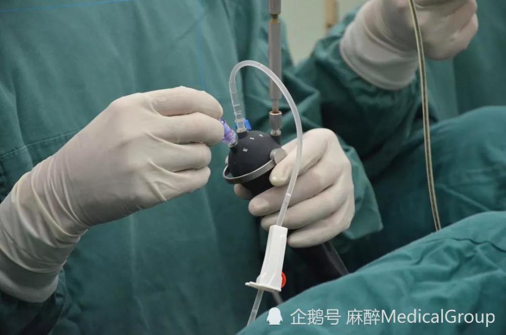 听说输尿管软镜能清除肾结石,疼不疼?