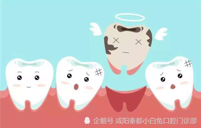 牙齿缺失是指牙齿数量上的缺失,一般缺失数量较大的以上颌牙齿侧面居