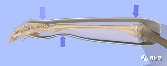 【骨科小技巧】桡骨远端骨折闭合复位!