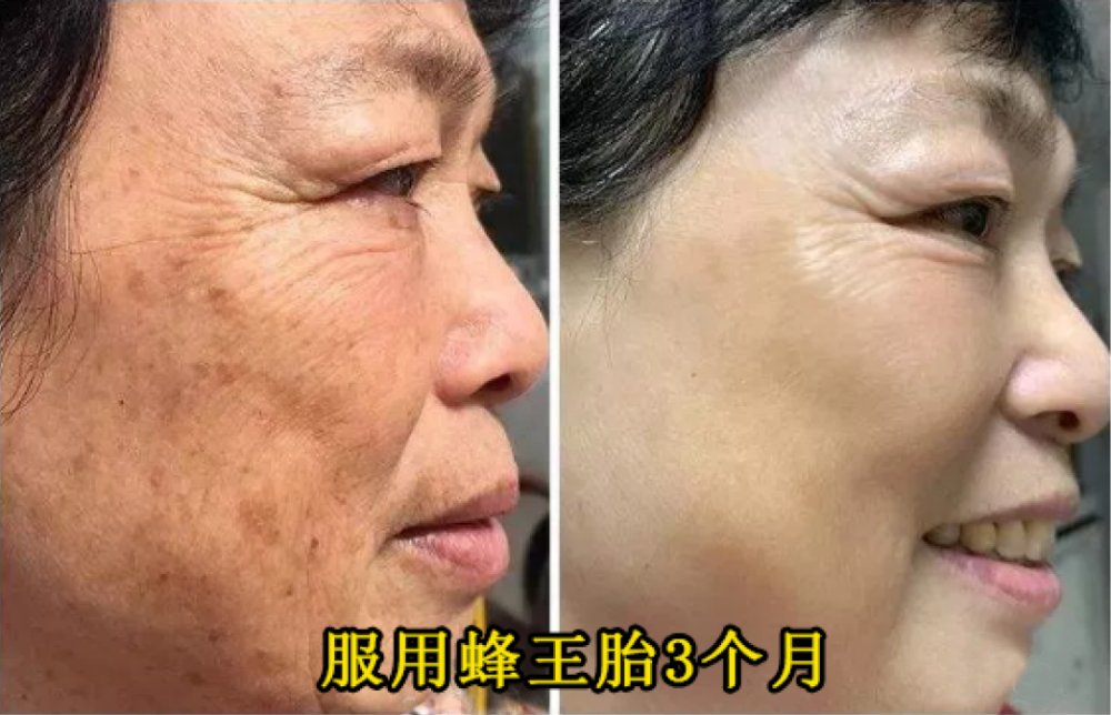 睡前吃几片,坚持半月,脸色红润,精神好了,宛如少女!