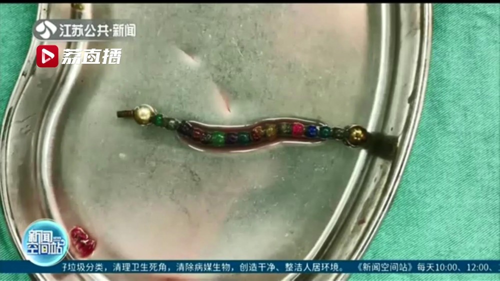 医生检查后发现,欣欣的腹腔内有一串珠状异物,并形成部分肠梗阻以及胃