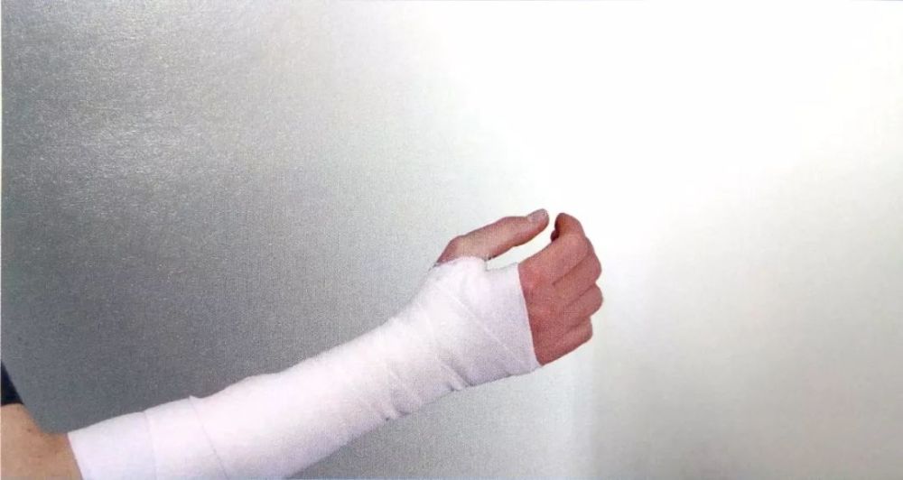 腕关节绷带固定法 适应证: 1,腕关节拉伤 2,腕关节扭伤