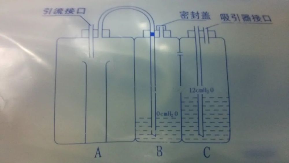 大家对三瓶负压水封瓶比较陌生,在临床应用过程中有没有该注意的事项