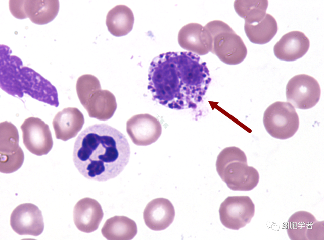 嗜酸性分叶核粒细胞  09