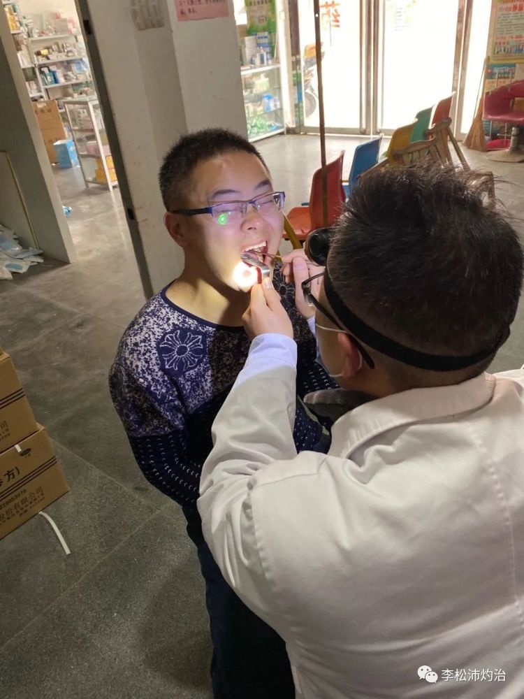 扁桃体肥大非常有效的治疗方法——中医扁桃体灼烙技术!