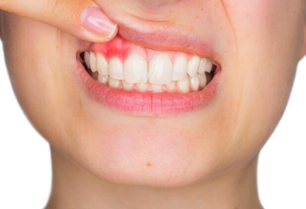 解密我经常梦见掉牙齿的深层预兆，从心理到身体的全面解析