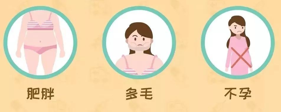 多囊卵巢综合征的3大症状,你有没有?