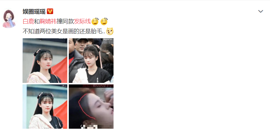 白鹿胎毛发际线抢眼,被质疑模仿鞠婧祎?得知真相秃头女孩羡慕了!