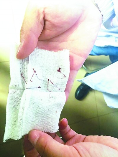 Ůʿ¡�Ǻ�Ǽⲻ��ð����ͷ �̺ۿ��޷��ָ�