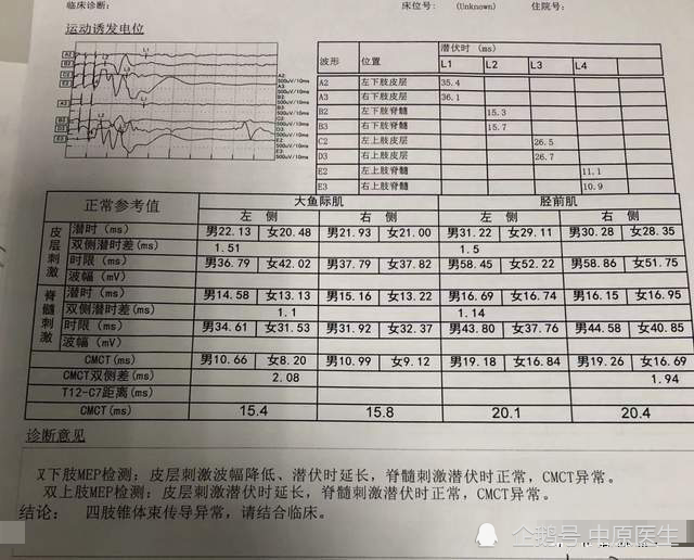 60岁男子四肢无力按脑梗塞治疗一年无效被省级专家确诊渐冻症