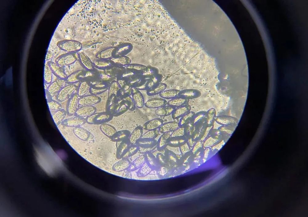 显微镜下的虫卵