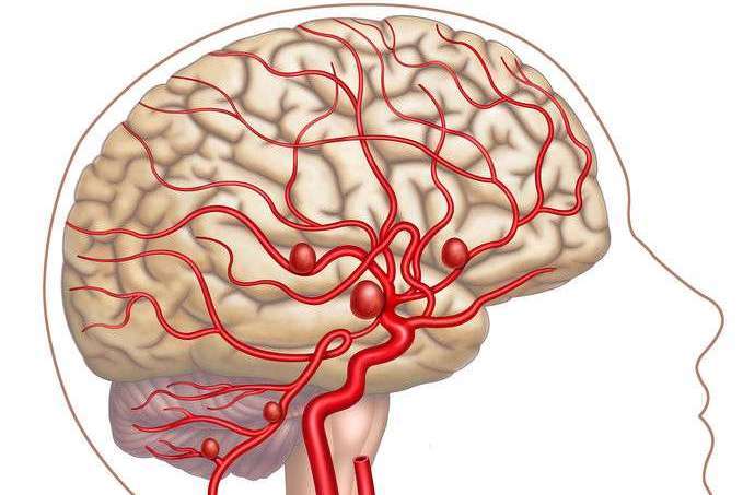 脑血管出现"硬化",人体6个表现藏不住,先自查
