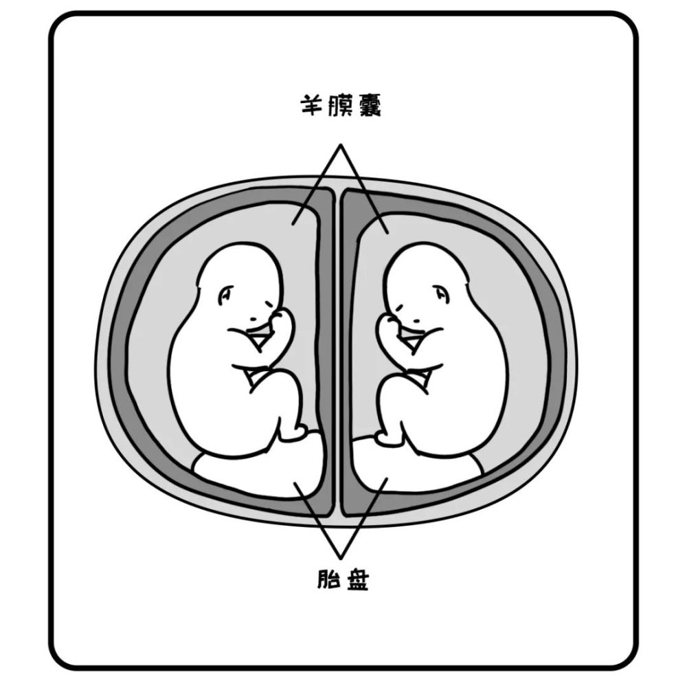 想要 做试管生双胞胎的妈妈就需要一次移植两个胚胎来形成 异卵双胞胎
