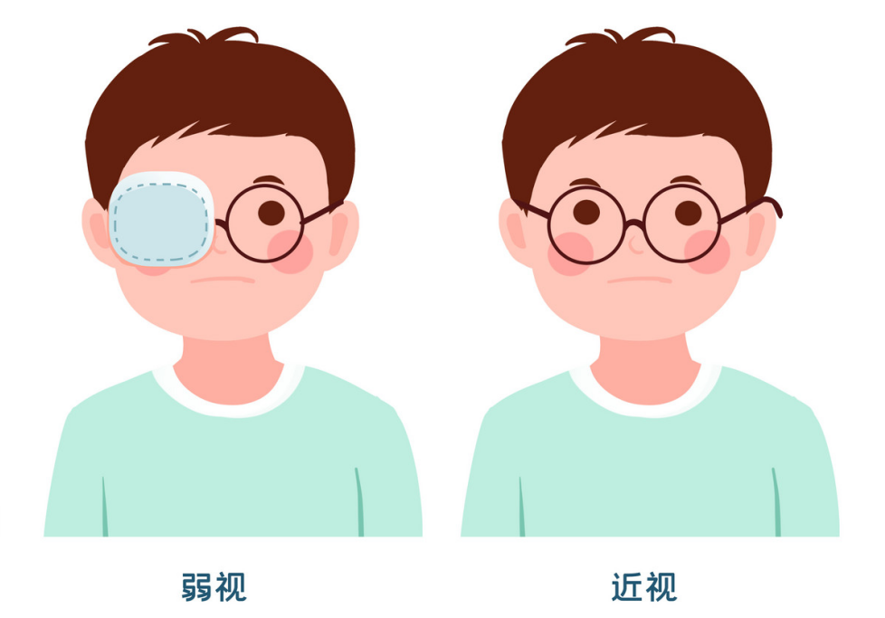 醒着的时候都建议戴;如双眼弱视程度不同或单眼弱视,每天需要遮盖视力