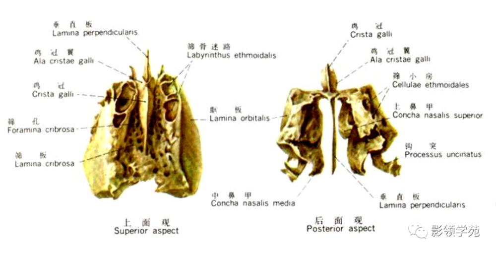 the ethmoid bone(筛骨)包括盲孔和筛孔蝶骨小翼和鞍结节为后界额骨