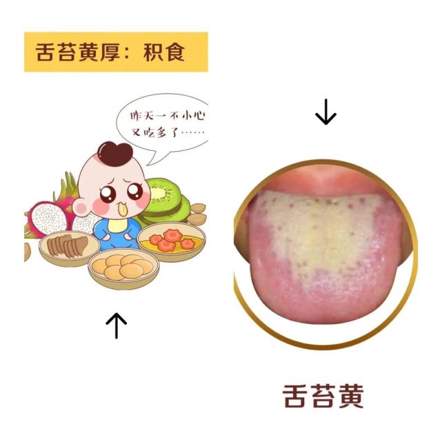 孩子舌苔都是怎么回事?教你了解舌苔的知识