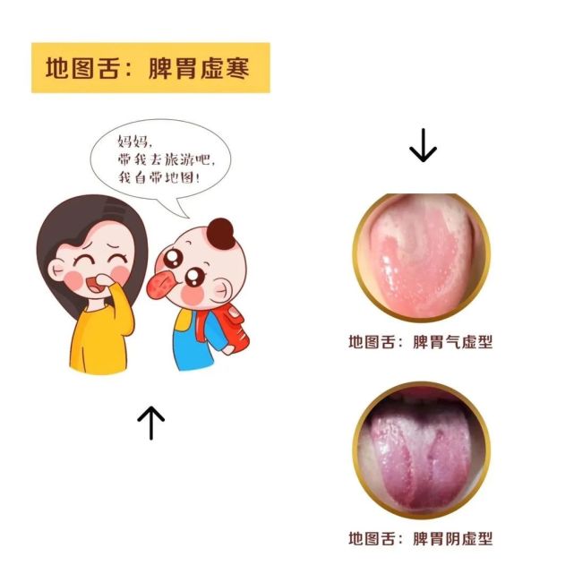 孩子舌苔都是怎么回事?教你了解舌苔的知识