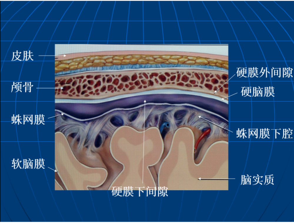我们的脑组织表面覆盖着三层膜,从外到内依次是硬脑膜,蛛网膜和软脑膜
