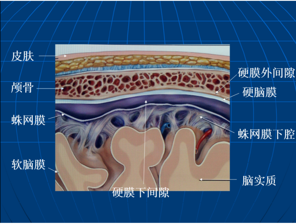 我们的脑组织表面覆盖着三层膜,从外到内依次是硬脑膜,蛛网膜和软
