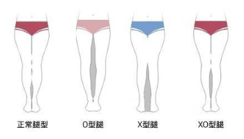腿型的自我判断 首先,我们得知道自己是什么腿,才能对症下药.