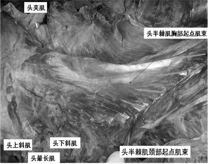 头最长肌头固有肌群-项下平面止点椎枕肌头伸肌群-项平面止点头半